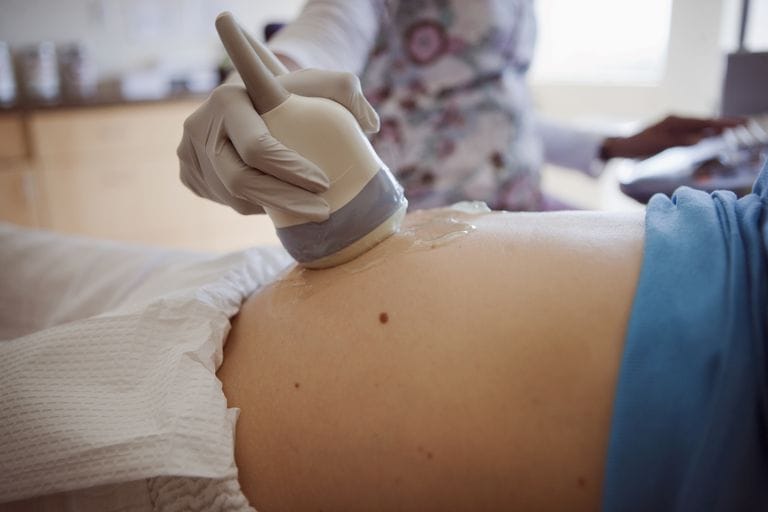sonography