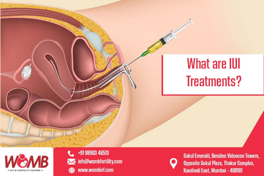 What are IUI Treatments | Womb IVF