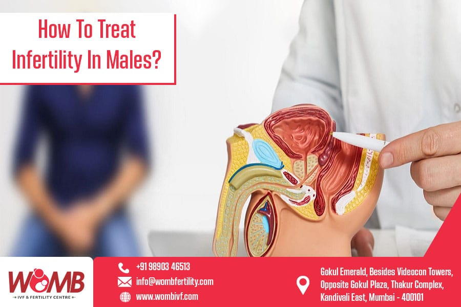 How to treat infertility in males | Womb IVF