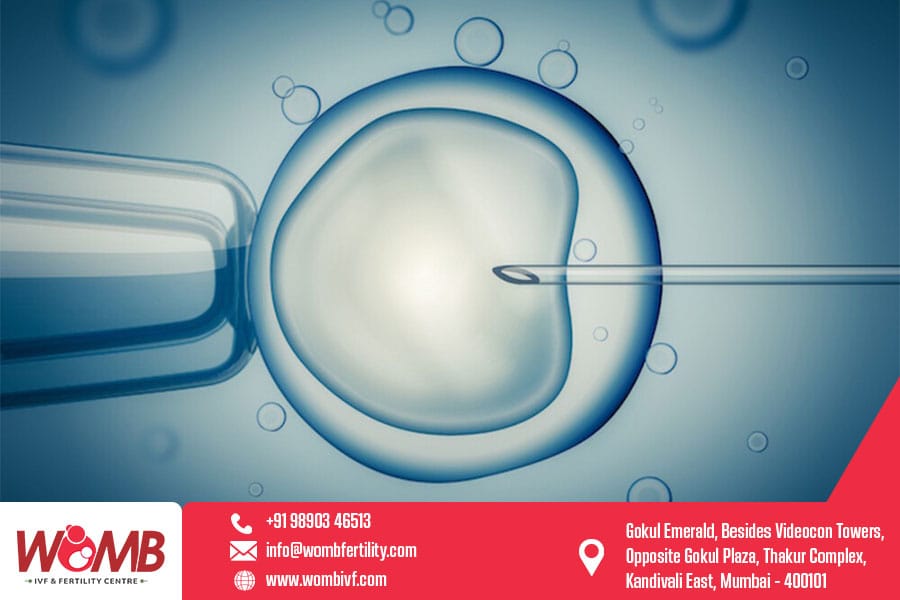 Intracytoplasmic Sperm Injection (Icsi) | Womb Ivf