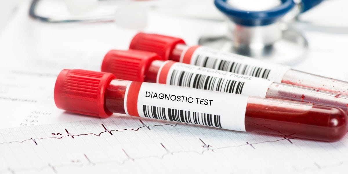 Common Tests Used in Infertility Diagnosis for Men and Women