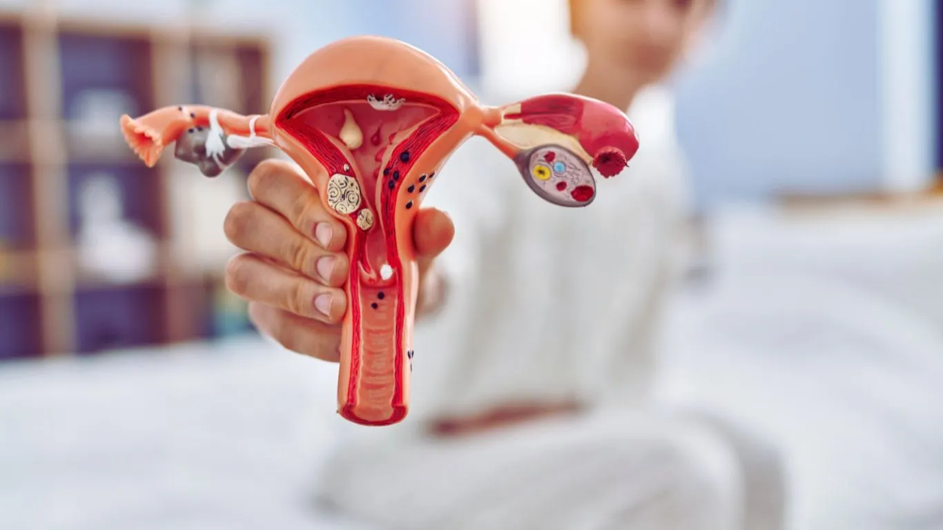Blocked Fallopian Tubes