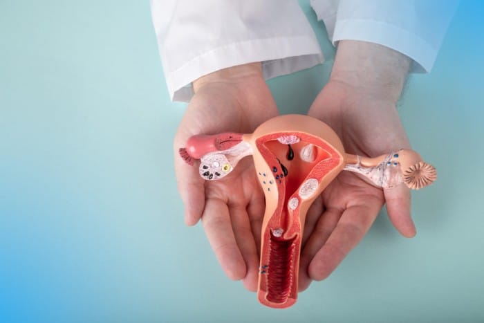 Endometriosis and Infertility Image