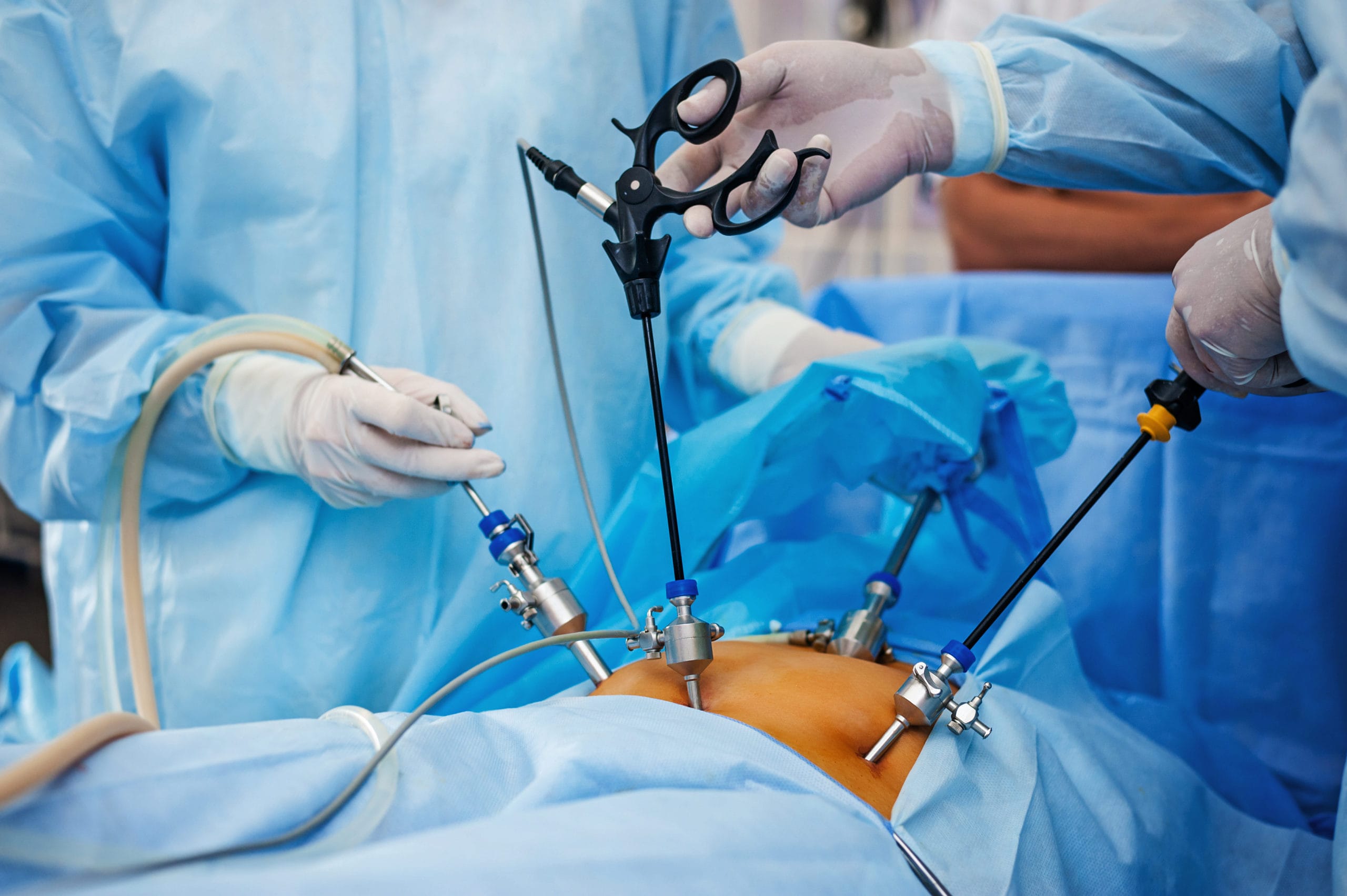 Laparoscopy for Infertility Diagnosis When Is It Required