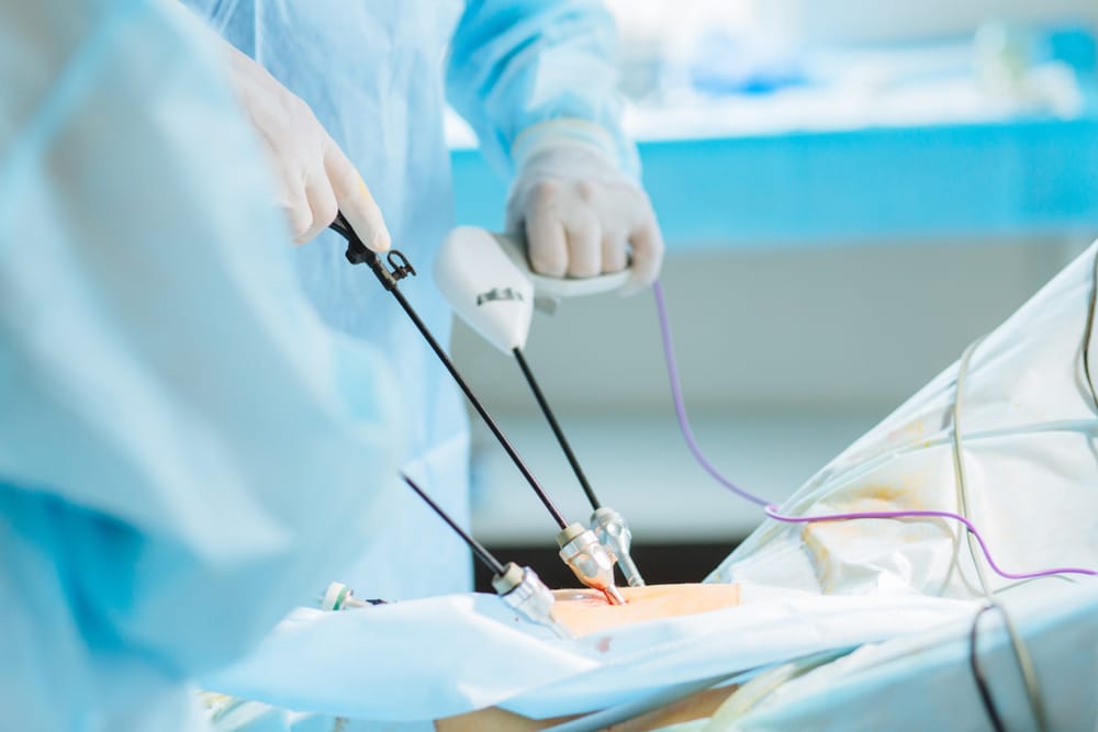 Laparoscopy for Infertility Diagnosis